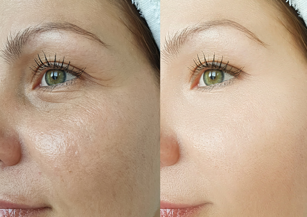 Cosa contiene l'Acmella?