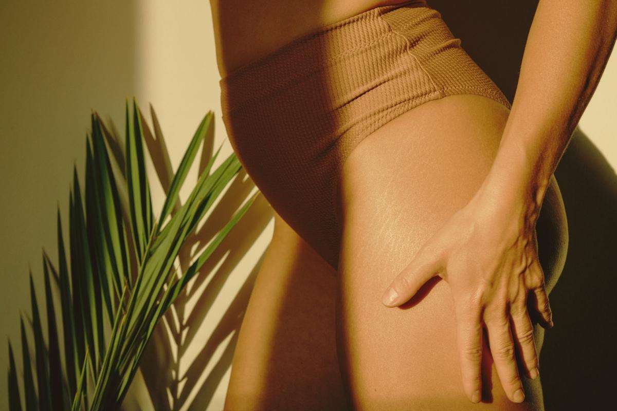 smagliature rosse fase iniziale